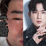 “신경 망가져 얼굴 마비”...몇 년간 <b>방치</b>해 뒀다가, 무슨 일?