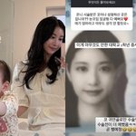 이렇게 쿨하다고?…성형 전후 공개 "코수술 <b>전이</b> 더 예뻤음"