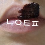 나 입술에 <b>피멍</b> 어캄ㅠ(약혐