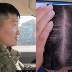 강형욱 휑한 정수리..갑질 논란 후 탈모 고백 “체중도 13kg...