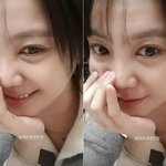 '<b>낙상</b> 사고' 고은아, "얼굴로 먹고 산다"더니…초근접 굴욕無...