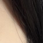 보톡스멍들어서 개처맞은불쌍한<b>사람됨</b>