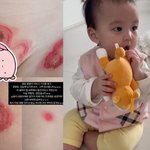 이지훈아야네 "8개월 딸, 피부병 더 번져 억장 와르르..누가...