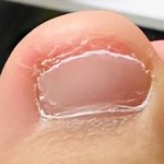 나 <b>발톱</b> 쥐가 파먹었는데 어떡해…