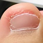 나 <b>발톱</b> 쥐가 파먹었는데 어떡해