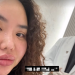 홍진영 언니 홍선영, 입술 필러 녹이나..자기관리 중인 근황