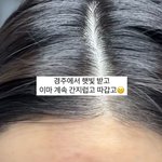 초아, <b>난임</b> 한의원 텐트런 후유증 "간지럽고 따가워"