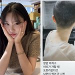 '암투병' 이솔이, <b>항암</b> 후 짧아진 머리+암수술 당시 공개 "이제야...