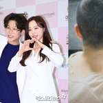 이유 "2세 못가져"·"<b>혈관</b> 다 녹아"·"머리 다 빠져