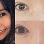 ‘눈 성형 4번’ 장영란, 자연美 추구에 응원 쏟아졌다 “나이 들어...