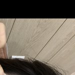 [어케생각해] <b>최악</b>의 피부과