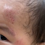 어린이집에서 다쳐도 문제제기하지말란 <b>동의서</b>