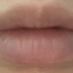 갑자기 입술 보라색되고 <b>혈색</b>없어짐