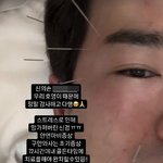 백지영 ‘안면마비’ 온 이민우에 “스트레스 줄여야 해” (‘살림남’)
