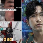 “점점 심해져…” 안면마비 온 이민우에 백지영이 건넨 조언은 밑줄...