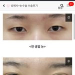 와 눈이 어떻게 이렇게 달라지지
