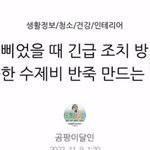[드루와] 남친 곧 군대가서 머리 밀었는데
