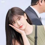 안유진 <b>다래끼</b> 상태 미쳤는데
