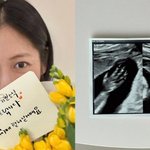 반소영, '1박 2일' 출신 <b>PD</b>와 결혼 4년 만에 임신 소식 전했다