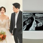 '1박 2일' 출신 <b>PD</b>반소영, 결혼 4년만 임신…'태명=칸쵸'...