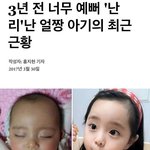 이 <b>아기</b> 근황아는<b>사람</b>