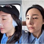 [댓글부탁해] '조혜련 올케' <b>박혜민</b>, 과하게 털털해…코 수술 후...