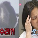 박나래 탈모 검사 결과 나왔는데 "여기는 아예 없다" 소리 들음ㄷㄷ