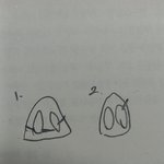 [어케생각해] 코 성형<b>흉터</b>