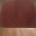 병원 <b>진료</b>거부 당한거 같아요ㅠ