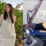  6월 결혼 앞두고…등에 <b>손바닥</b>만한 화상 "빨리 낫게 해주세요"