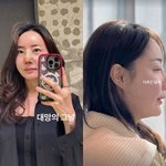 조혜련 올케 <b>박혜민</b>, 3번째 코수술로 완전히 딴 사람 됐다 “다른긴...