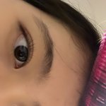 나 <b>쌍수</b> 한 거 티 많이남?