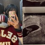 '남태현과 마약' 서민재, 열애설 건너뛰고…임신 발표+남친 공개...