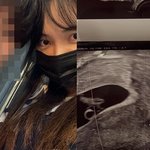 '남태현과 마약' 서민재, 엄마 됐다…연인은 97년생+초음파 인증...