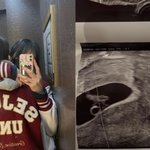 '마약 투약' 서민재, 깜짝 임신 발표 "아빠 된 거 축하해"