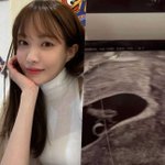 서민재, 엄마된 충격 근황..'초음파 사진' 공개 (<b>Oh</b>!쎈 이슈)