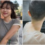 ‘박성광’ 이솔이 “여성암 투병, 속눈썹 다 빠지고 손도 까매져”