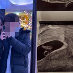 [팝업]‘마약전과’ 서민재, 새출발 하더니 깜짝 임신 발표..반응...