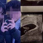 [어케생각해] 서민재, 마약 전과→혼전 임신 발표…'필로폰 부작용'...