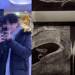 "아빠 된 거 축하해"…'하트시그널3' 서민재, 깜짝 임신 발표
