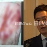 녹취 제보자 목 9번 찔렸대 <b>FBI수사</b>까지 들어가고 그냥 미친 것...