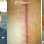 제보자가 "사실 팔 다쳤다" <b>번복</b>하고 상처 사진도 가짜 인정함