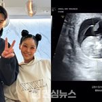 래퍼 트루디 임신 발표함 태명이랑 초음파 사진 다 공개 ㄷㄷ