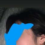 나 <b>사각</b>턱 개심한데 보톡스