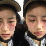 남자한테 얻어 맞는 여자 특