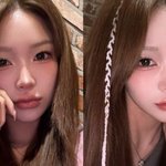 최진실 딸' 최준희, 눈+코 성형 이어..."또 수술하러 가요"...