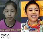 <b>치아</b>교정으로 다시 태어난 스타
