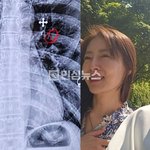 개그맨 이정수 아내가 갑자기 호흡곤란 와서 조마했는데했는데 병원...