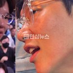 레슬링 보러갔다가 아들앞에서 <b>레슬러</b>에게 뺨 따귀맞고 자국생겼네 ㄷㄷ