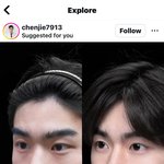 성형<b>전후</b> ㄹㅈㄷ